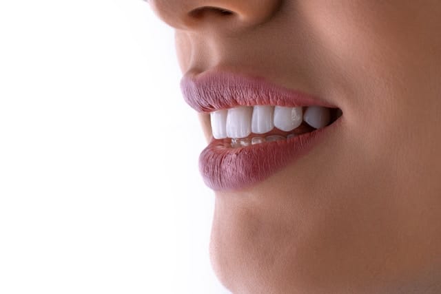 Smile Design