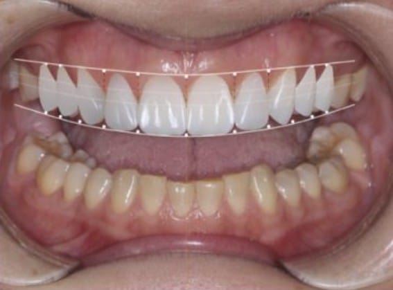 New Smile
